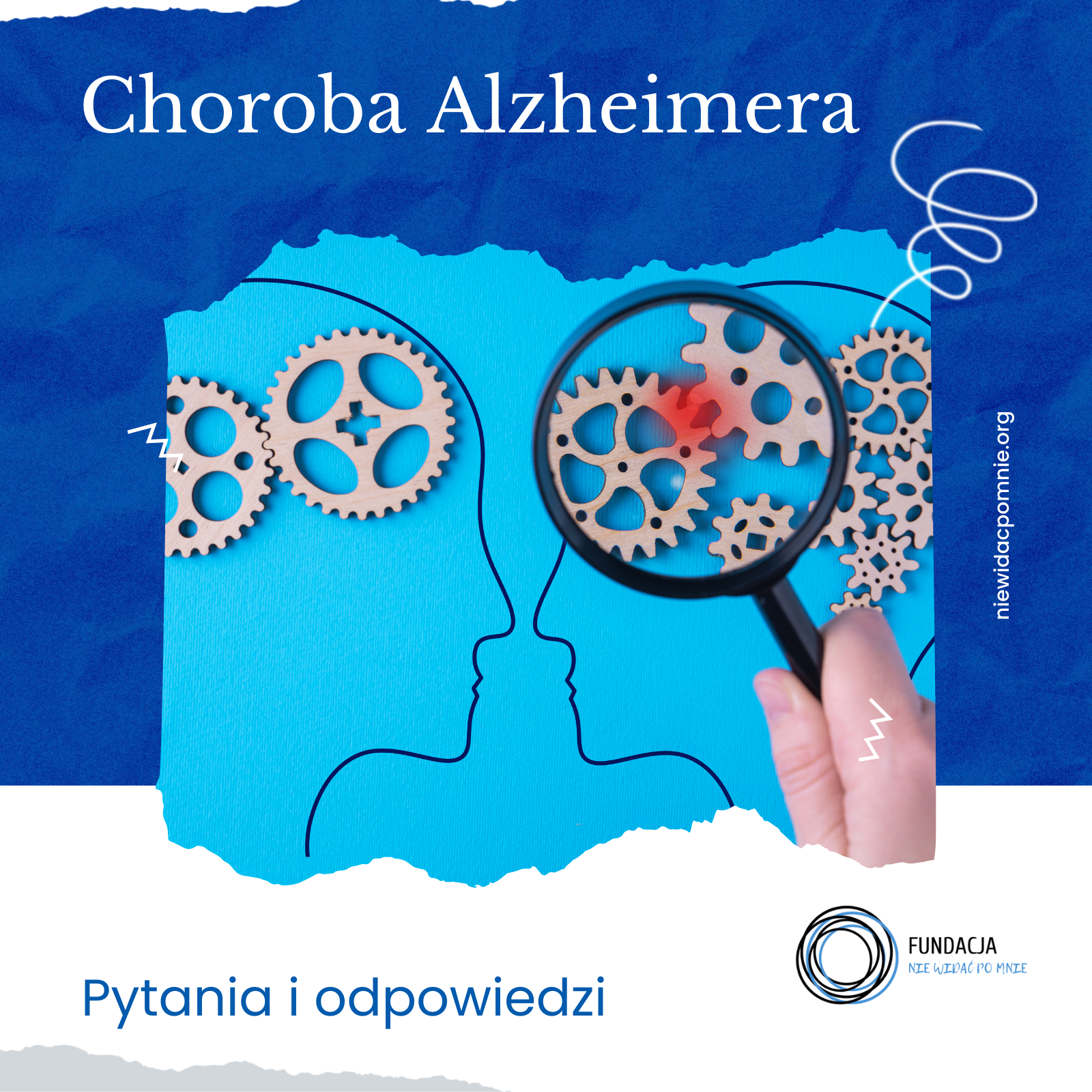 Choroba Alzheimera – pytania i odpowiedzi